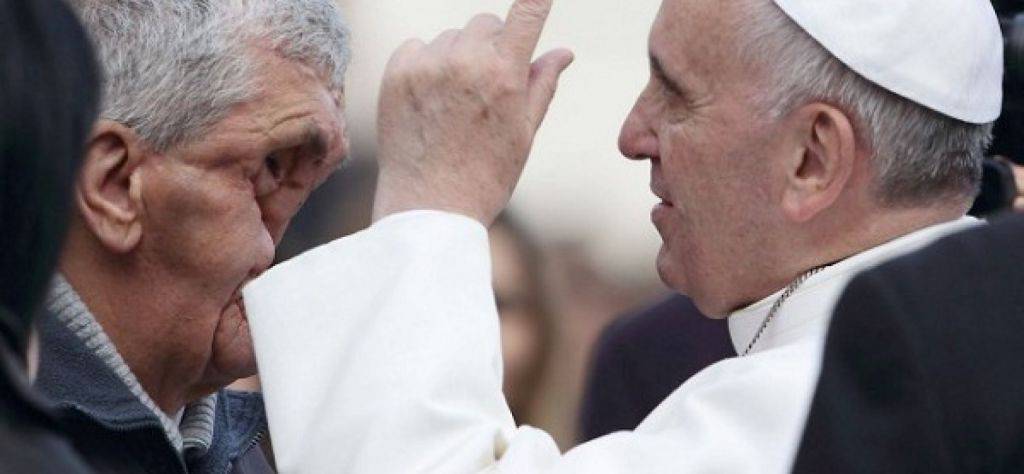 Papa-Francesco-abbraccia-luomo-dal-viso-sfigurato-FOTO1-1728x800_c