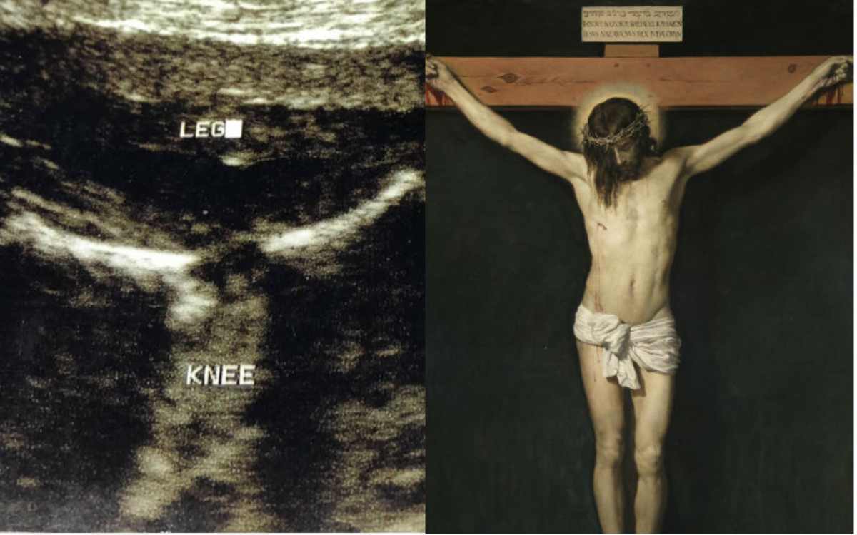 Jesus-and-sonogram1-1